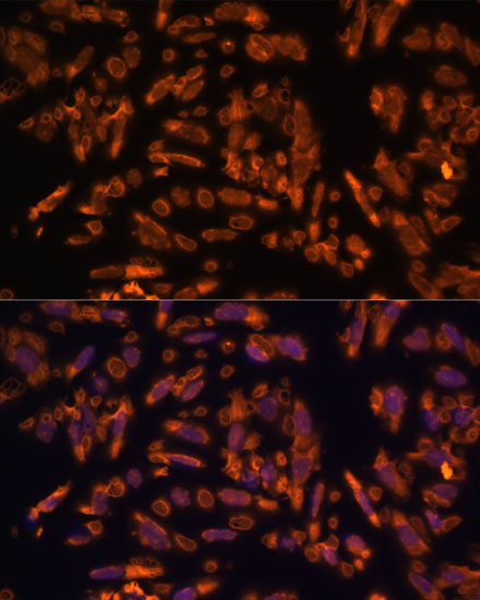 PRX Rabbit Polyclonal Antibody - Image 4