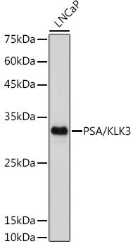 PSA/KLK3 Rabbit Monoclonal Antibody