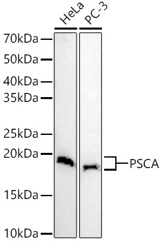 PSCA Rabbit Polyclonal Antibody