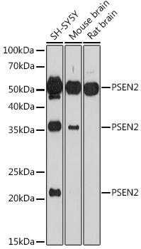 PSEN2 Rabbit Polyclonal Antibody