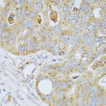 PSG1 Rabbit Polyclonal Antibody - Image 2