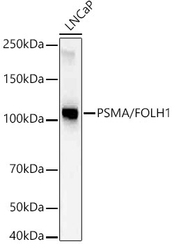 PSMA/FOLH1 Rabbit Monoclonal Antibody