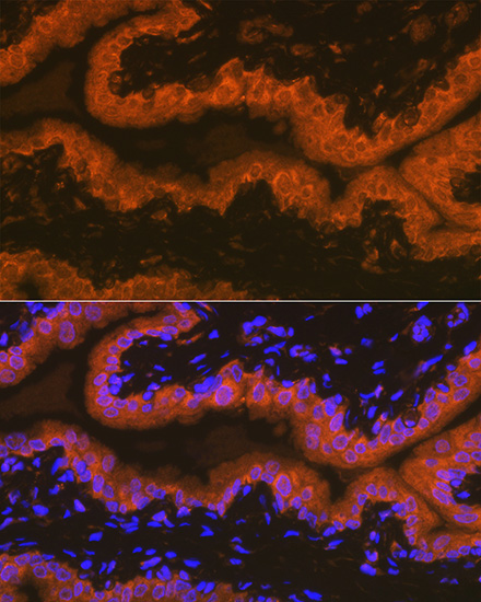 PSMA/FOLH1 Rabbit Monoclonal Antibody - Image 2