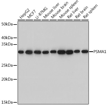 PSMA1 Rabbit Monoclonal Antibody