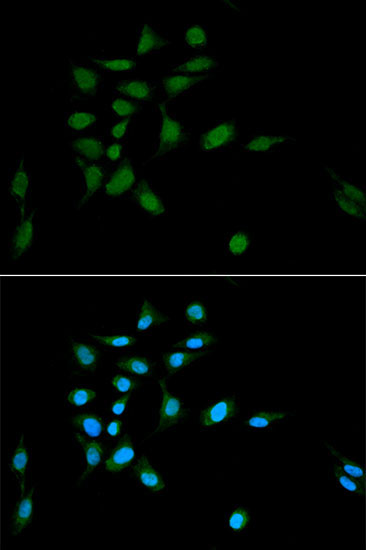 PSMA1 Rabbit Polyclonal Antibody - Image 2