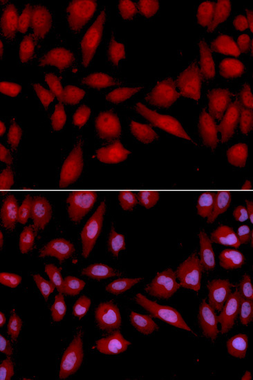 PSMA2 Rabbit Polyclonal Antibody - Image 2