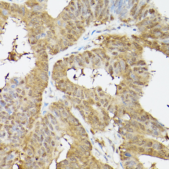 PSMA3 Rabbit Polyclonal Antibody - Image 2