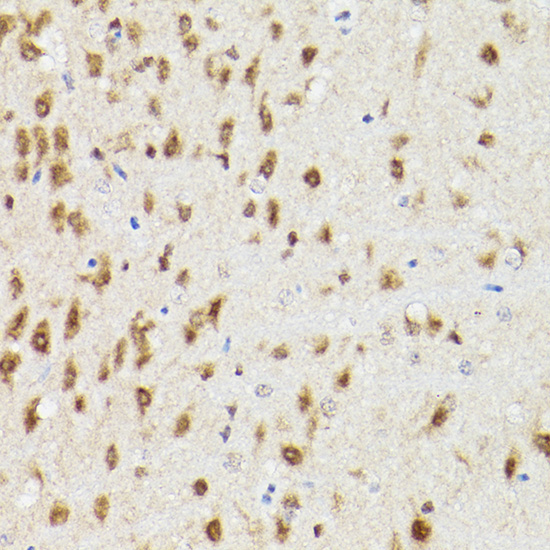 PSMA3 Rabbit Polyclonal Antibody - Image 4