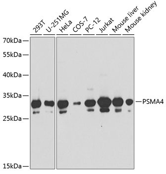 PSMA4 Rabbit Polyclonal Antibody