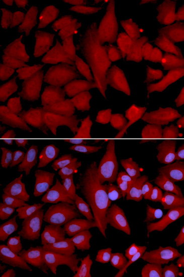PSMA4 Rabbit Polyclonal Antibody - Image 2