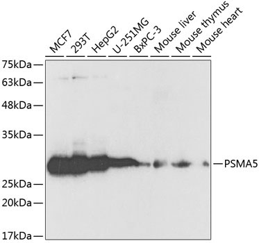 PSMA5 Rabbit Polyclonal Antibody