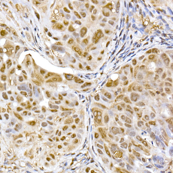 PSMA5 Rabbit Polyclonal Antibody - Image 2
