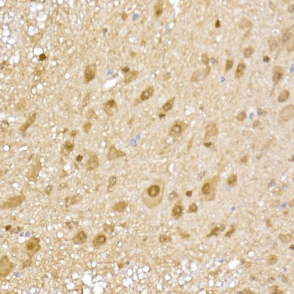 PSMA5 Rabbit Polyclonal Antibody - Image 3