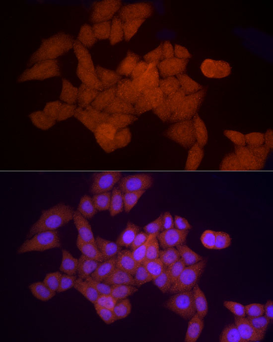 PSMA5 Rabbit Polyclonal Antibody - Image 5