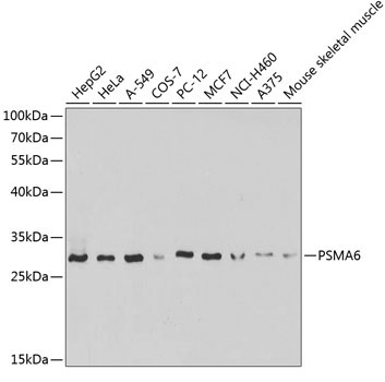 PSMA6 Rabbit Polyclonal Antibody
