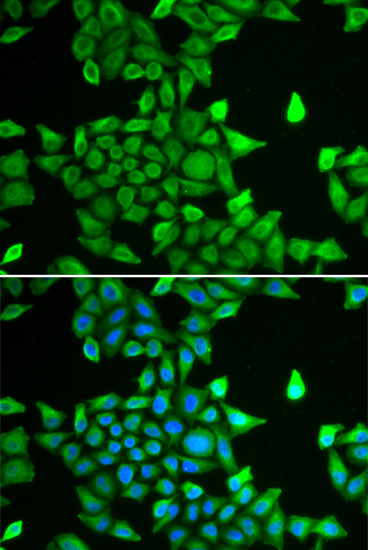 PSMA6 Rabbit Polyclonal Antibody - Image 2
