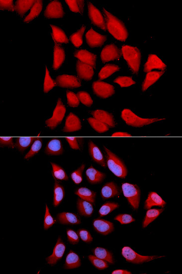 PSMA6 Rabbit Polyclonal Antibody - Image 2