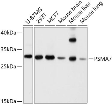 PSMA7 Rabbit Polyclonal Antibody