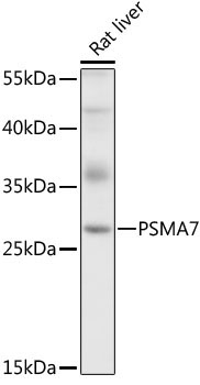 PSMA7 Rabbit Polyclonal Antibody - Image 2