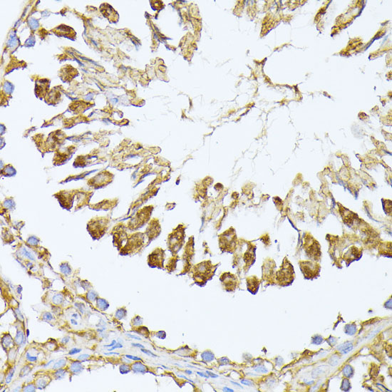 PSMA7 Rabbit Polyclonal Antibody - Image 3