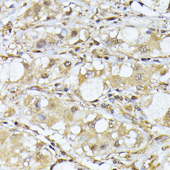 PSMA7 Rabbit Polyclonal Antibody - Image 4