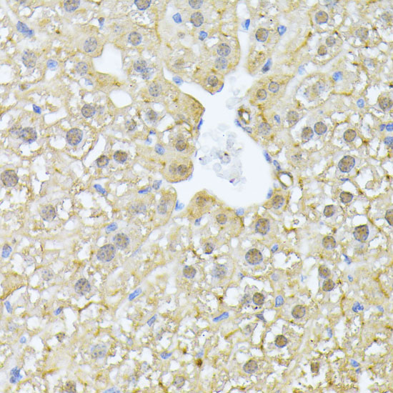 PSMA7 Rabbit Polyclonal Antibody - Image 5