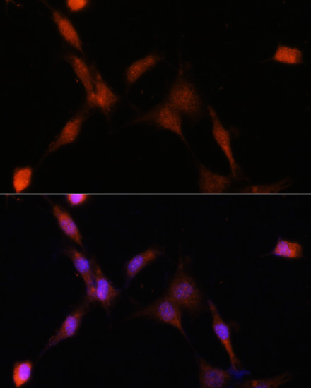 PSMA7 Rabbit Polyclonal Antibody - Image 6