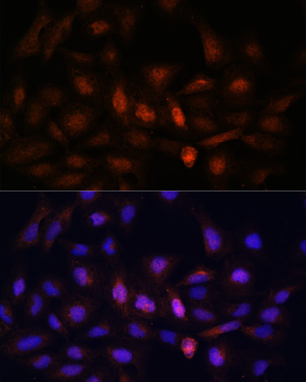 PSMA7 Rabbit Polyclonal Antibody - Image 7