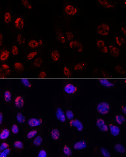 PSMB1 Rabbit Polyclonal Antibody - Image 2