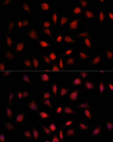 PSMB1 Rabbit Polyclonal Antibody - Image 3