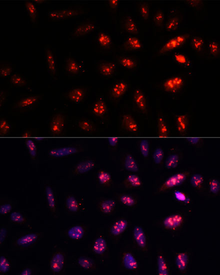 PSMB1 Rabbit Polyclonal Antibody - Image 4