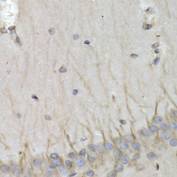 PSMB10 Rabbit Polyclonal Antibody - Image 2