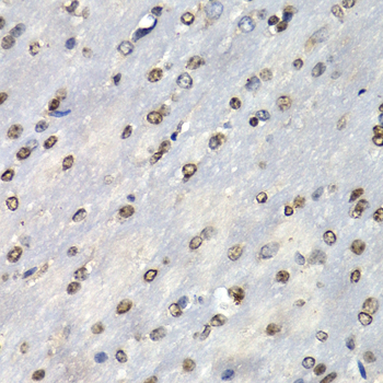 PSMB10 Rabbit Polyclonal Antibody - Image 3