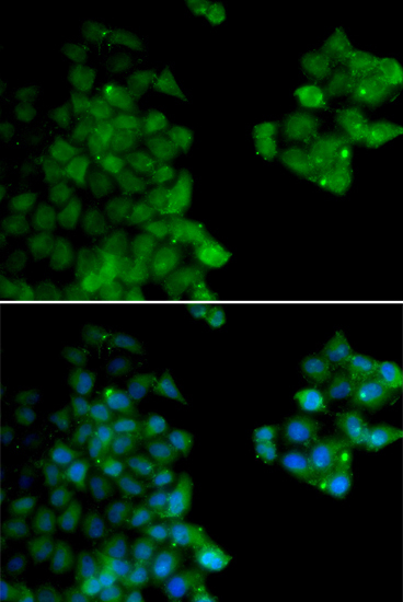 PSMB10 Rabbit Polyclonal Antibody - Image 4