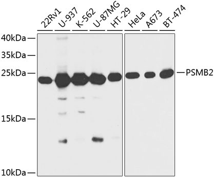 PSMB2 Rabbit Polyclonal Antibody