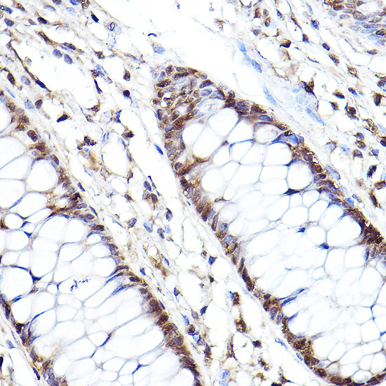 PSMB2 Rabbit Polyclonal Antibody - Image 2