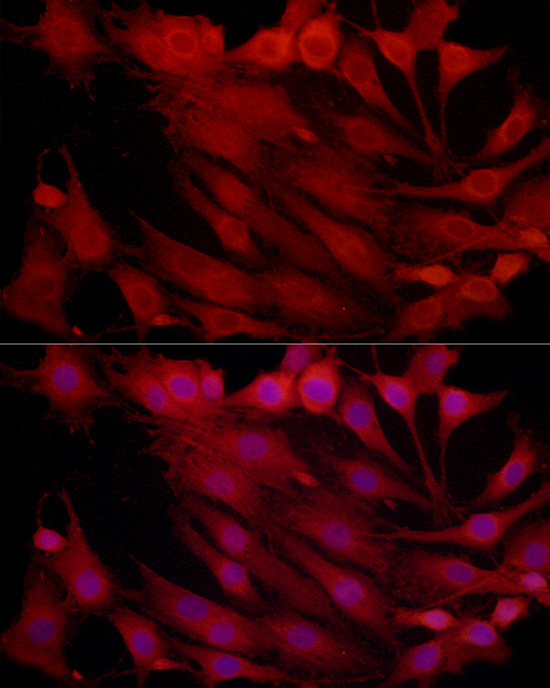 PSMB2 Rabbit Polyclonal Antibody - Image 3