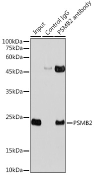 PSMB2 Rabbit Polyclonal Antibody - Image 4