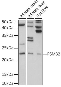 PSMB2 Rabbit Polyclonal Antibody - Image 2