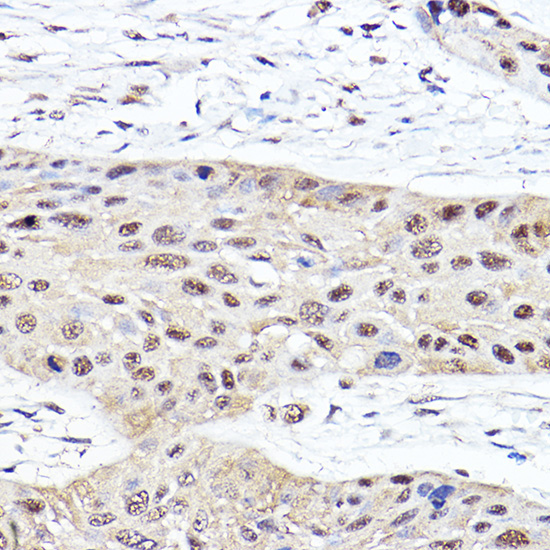 PSMB2 Rabbit Polyclonal Antibody - Image 3