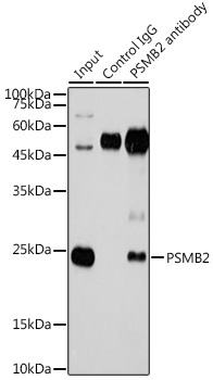 PSMB2 Rabbit Polyclonal Antibody - Image 4
