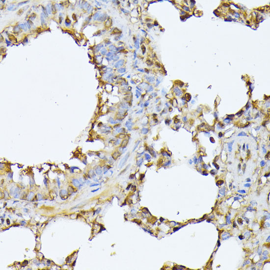 PSMB3 Rabbit Polyclonal Antibody - Image 2