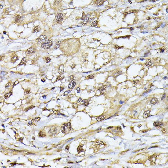 PSMB3 Rabbit Polyclonal Antibody - Image 3