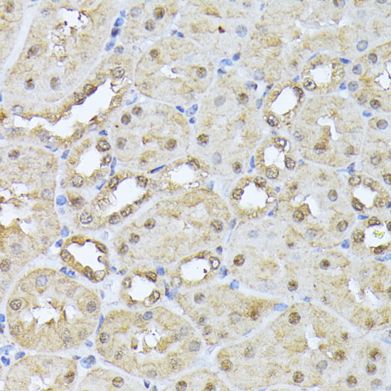 PSMB3 Rabbit Polyclonal Antibody - Image 4
