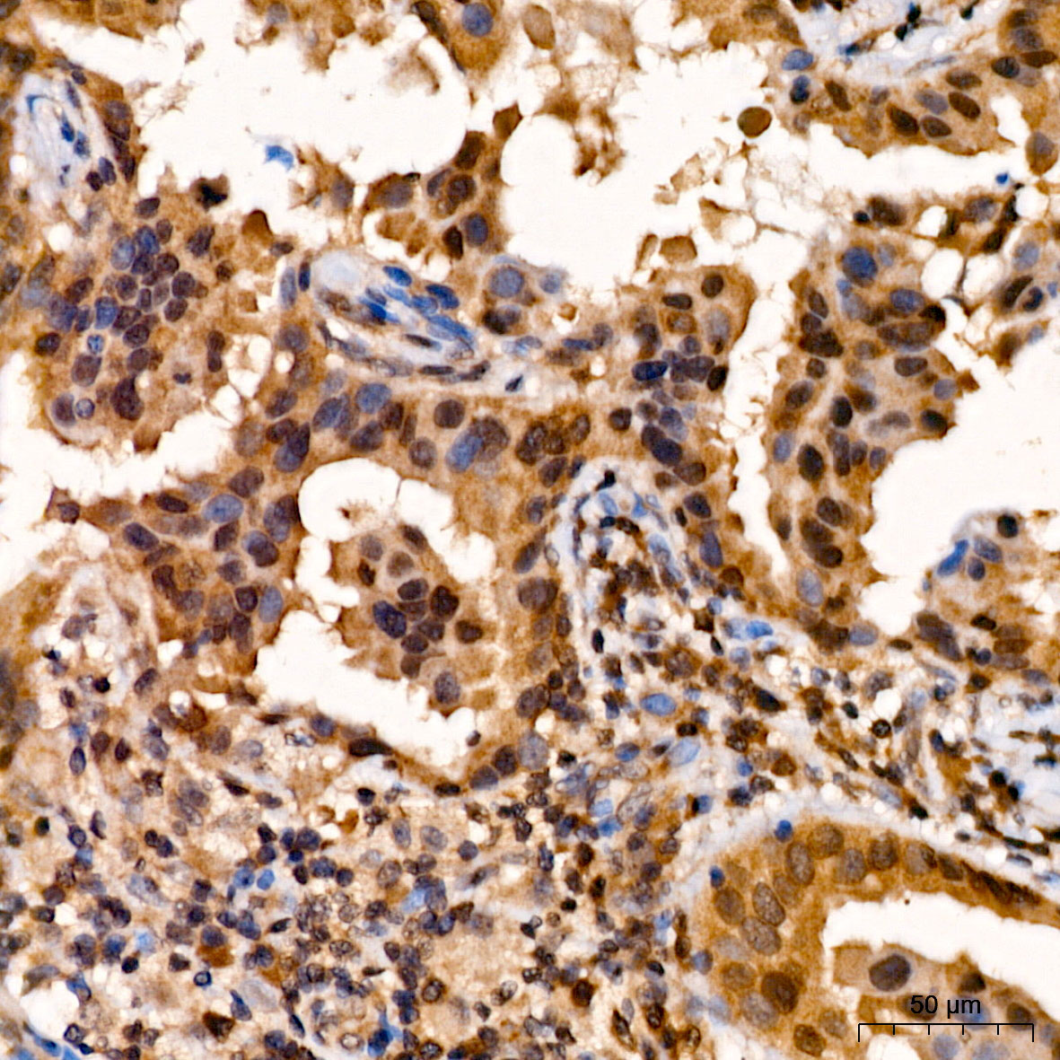 PSMB5 Rabbit Polyclonal Antibody - Image 2