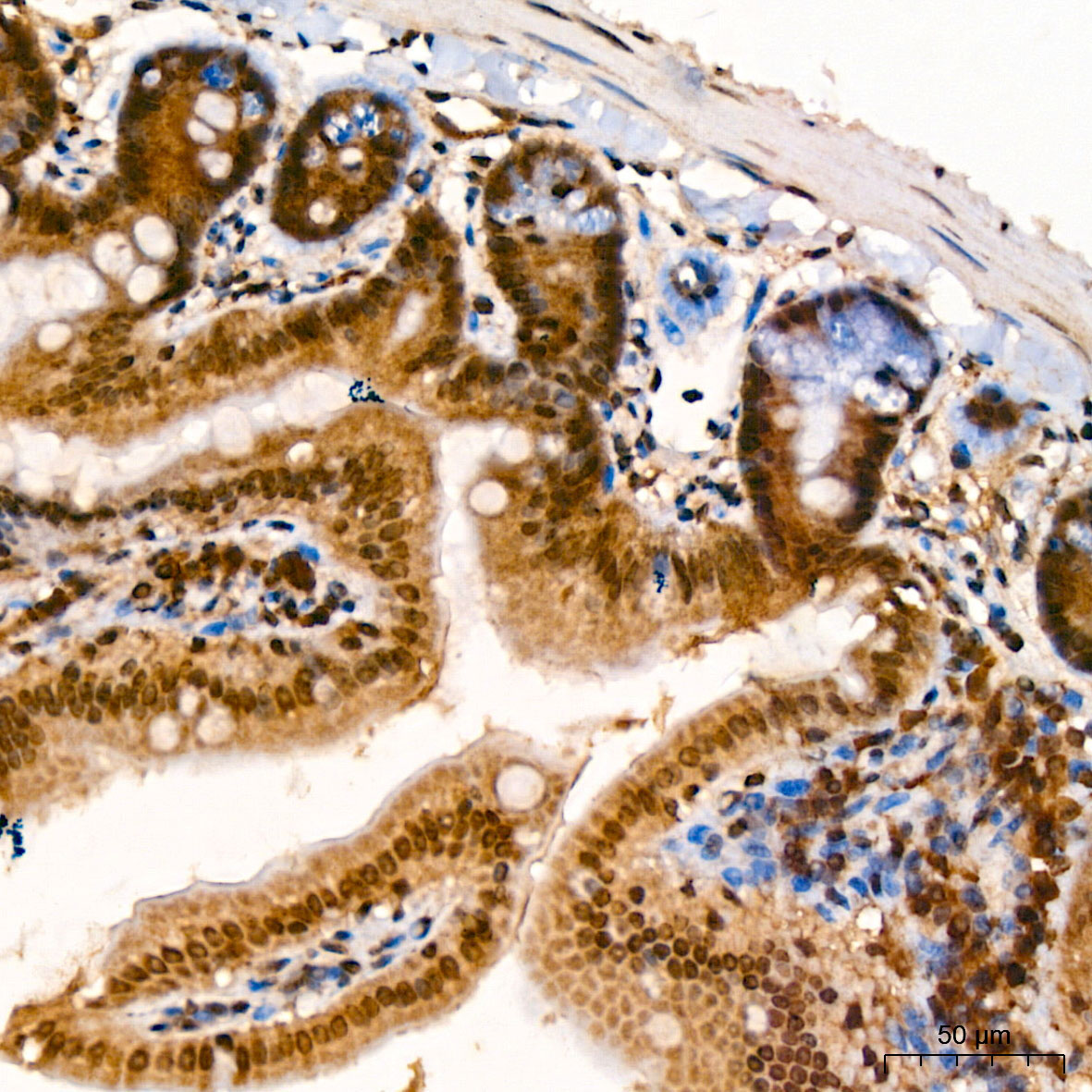 PSMB5 Rabbit Polyclonal Antibody - Image 3