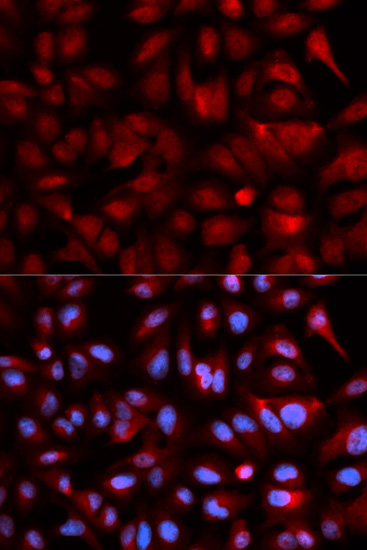 PSMB5 Rabbit Polyclonal Antibody - Image 4