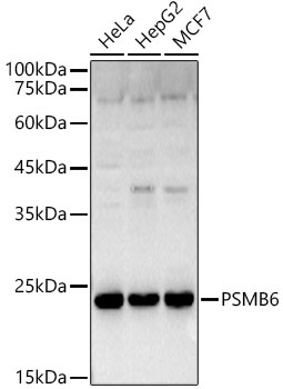 PSMB6 Rabbit Polyclonal Antibody