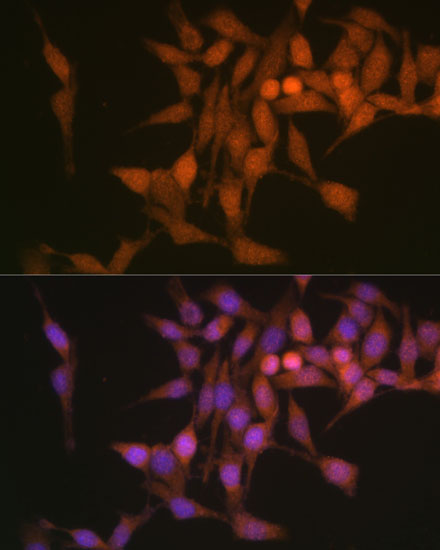 PSMB6 Rabbit Polyclonal Antibody - Image 2