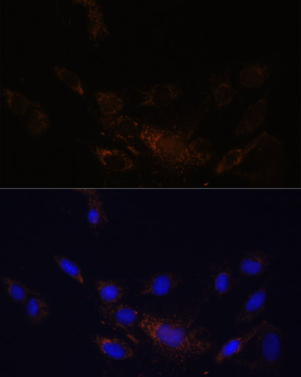 PSMB7 Rabbit Polyclonal Antibody - Image 2